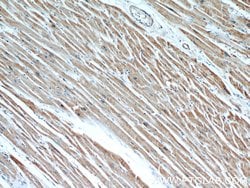 CPT1A Mouse anti-Human, Mouse, Rat, Clone: 5D8G9, Proteintech:Antibodies:Primary