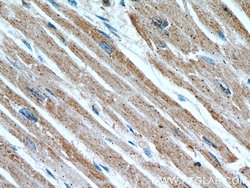 CPT1A Mouse anti-Human, Mouse, Rat, Clone: 5D8G9, Proteintech:Antibodies:Primary