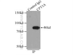 CPT1A Mouse anti-Human, Mouse, Rat, Clone: 5D8G9, Proteintech:Antibodies:Primary