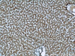 CPT1A Mouse anti-Human, Mouse, Rat, Clone: 5D8G9, Proteintech:Antibodies:Primary