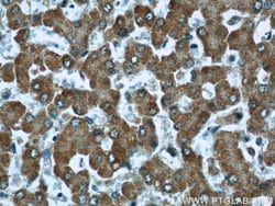 CPT1A Mouse anti-Human, Mouse, Rat, Clone: 5D8G9, Proteintech:Antibodies:Primary