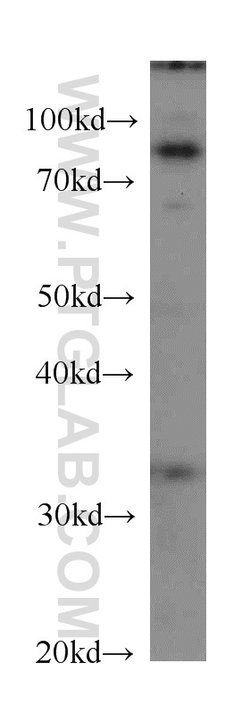CPT1A Mouse anti-Human, Mouse, Rat, Clone: 5D8G9, Proteintech:Antibodies:Primary