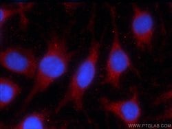 LONP1 Mouse anti-Human, Mouse, Rat, Clone: 1C6C12, Proteintech 150 &mu;L;