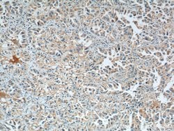 LONP1 Mouse anti-Human, Mouse, Rat, Clone: 1C6C12, Proteintech 150 &mu;L;