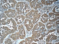 LONP1 Mouse anti-Human, Mouse, Rat, Clone: 1C6C12, Proteintech 150 &mu;L;