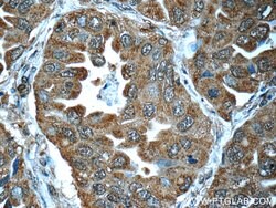 LONP1 Mouse anti-Human, Mouse, Rat, Clone: 1C6C12, Proteintech 150 &mu;L;