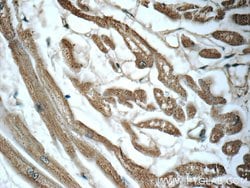 LONP1 Mouse anti-Human, Mouse, Rat, Clone: 1C6C12, Proteintech 150 &mu;L;