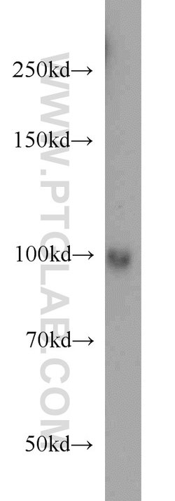 LONP1 Mouse anti-Human, Mouse, Rat, Clone: 1C6C12, Proteintech 150 &mu;L;