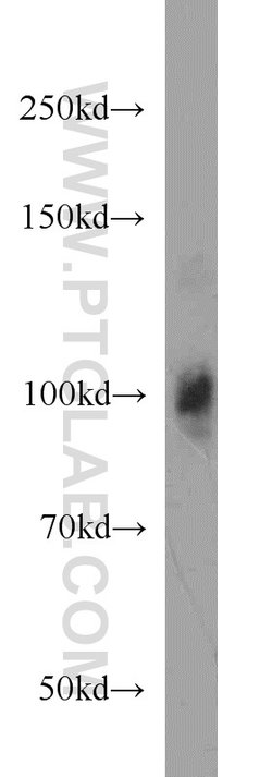 LONP1 Mouse anti-Human, Mouse, Rat, Clone: 1C6C12, Proteintech 150 &mu;L;