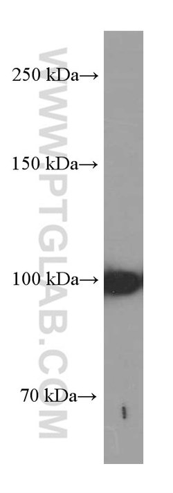 LONP1 Mouse anti-Human, Mouse, Rat, Clone: 1C6C12, Proteintech 150 &mu;L;