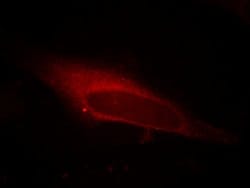 LPCAT1 Mouse anti-Human, Mouse, Rat, Clone: 8B6E9, Proteintech:Antibodies:Primary