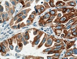 LPCAT1 Mouse anti-Human, Mouse, Rat, Clone: 8B6E9, Proteintech:Antibodies:Primary