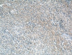 LPCAT1 Mouse anti-Human, Mouse, Rat, Clone: 8B6E9, Proteintech:Antibodies:Primary