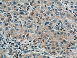 LPCAT1 Mouse anti-Human, Mouse, Rat, Clone: 8B6E9, Proteintech:Antibodies:Primary