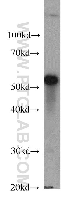 LPCAT1 Mouse anti-Human, Mouse, Rat, Clone: 8B6E9, Proteintech:Antibodies:Primary