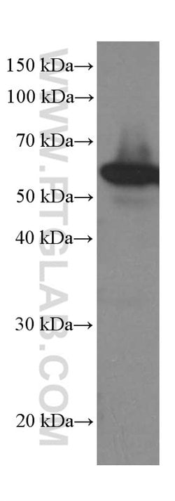 LPCAT1 Mouse anti-Human, Mouse, Rat, Clone: 8B6E9, Proteintech:Antibodies:Primary