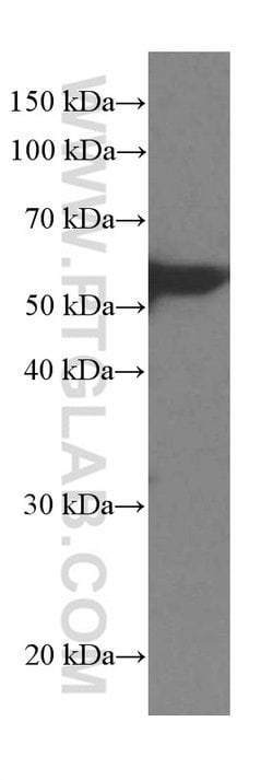 LPCAT1 Mouse anti-Human, Mouse, Rat, Clone: 8B6E9, Proteintech:Antibodies:Primary