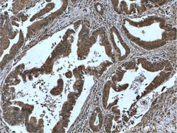 IA-2/PTPRN Mouse anti-Human, Clone: 1D3F5, Proteintech:Antibodies:Primary