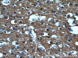 IA-2/PTPRN Mouse anti-Human, Clone: 1D3F5, Proteintech:Antibodies:Primary