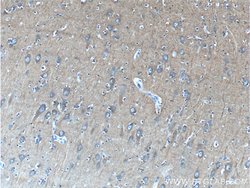 IA-2/PTPRN Mouse anti-Human, Clone: 1D3F5, Proteintech:Antibodies:Primary