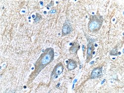 IA-2/PTPRN Mouse anti-Human, Clone: 1D3F5, Proteintech:Antibodies:Primary