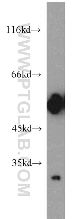 IA-2/PTPRN Mouse anti-Human, Clone: 1D3F5, Proteintech:Antibodies:Primary