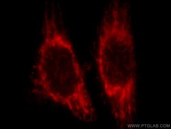 NDUFA4L2 Mouse anti-Human, Clone: 1G1H10, Proteintech:Antibodies:Primary