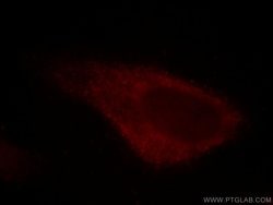 PA2G4 Mouse anti-Human, Mouse, Rat, Clone: 3G10D9, Proteintech 150 &mu;L;