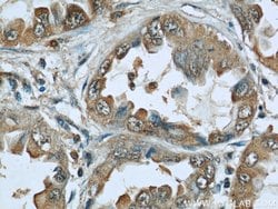 Caveolin-1 Mouse anti-Human, Mouse, Porcine, Rat, Clone: 6C2B2, Proteintech:Antibodies:Primary