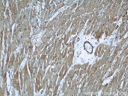 Caveolin-1 Mouse anti-Human, Mouse, Porcine, Rat, Clone: 6C2B2, Proteintech:Antibodies:Primary
