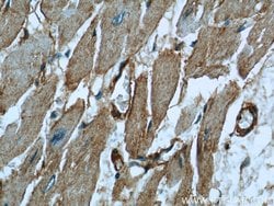 Caveolin-1 Mouse anti-Human, Mouse, Porcine, Rat, Clone: 6C2B2, Proteintech:Antibodies:Primary