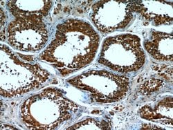 CPT1C Mouse anti-Human, Porcine, Clone: 5D11B5, Proteintech 150 &mu;L;
