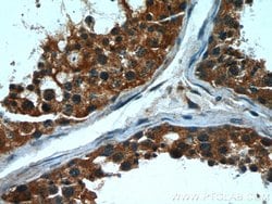 CPT1C Mouse anti-Human, Porcine, Clone: 5D11B5, Proteintech 150 &mu;L;