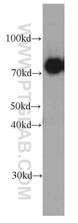 CPT1C Mouse anti-Human, Porcine, Clone: 5D11B5, Proteintech 150 &mu;L;