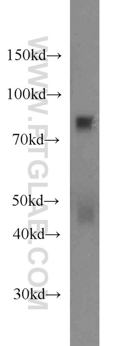 CPT1C Mouse anti-Human, Porcine, Clone: 5D11B5, Proteintech 150 &mu;L;