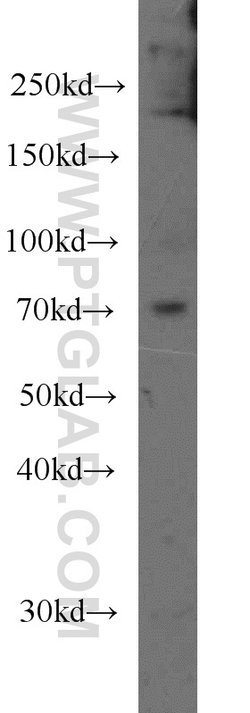 CPT1C Mouse anti-Human, Porcine, Clone: 5D11B5, Proteintech 150 &mu;L;