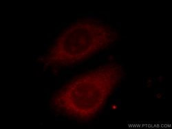 TELO2 Mouse anti-Human, Rat, Clone: 3H10F4, Proteintech 20 &mu;L; Unconjugated:Antibodies,