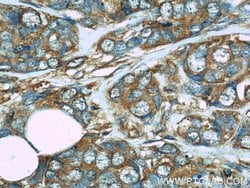 FHIT Mouse anti-Human, Clone: 4D6G1, Proteintech 150 &mu;L; Unconjugated:Antibodies,