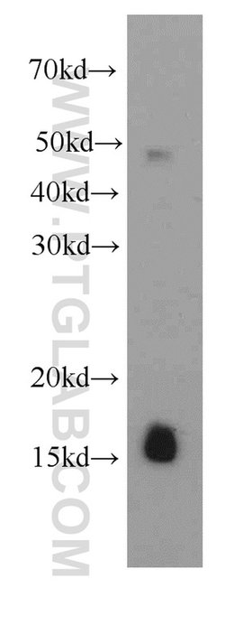 FHIT Mouse anti-Human, Clone: 4D6G1, Proteintech 150 &mu;L; Unconjugated:Antibodies,