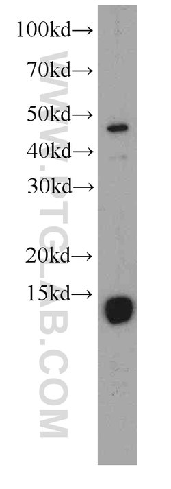 FHIT Mouse anti-Human, Clone: 4D6G1, Proteintech 150 &mu;L; Unconjugated:Antibodies,