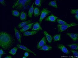 NCALD Mouse anti-Human, Clone: 6B4E10, Proteintech:Antibodies:Primary Antibodies