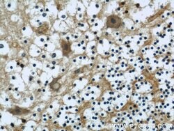 NCALD Mouse anti-Human, Clone: 6B4E10, Proteintech:Antibodies:Primary Antibodies