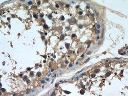 NCALD Mouse anti-Human, Clone: 6B4E10, Proteintech:Antibodies:Primary Antibodies