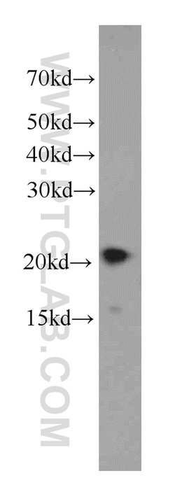 NCALD Mouse anti-Human, Clone: 6B4E10, Proteintech:Antibodies:Primary Antibodies