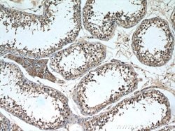 NCALD Mouse anti-Human, Clone: 6B4E10, Proteintech