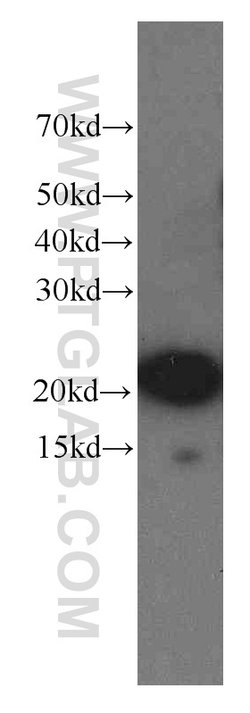 NCALD Mouse anti-Human, Clone: 6B4E10, Proteintech:Antibodies:Primary Antibodies