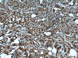 P4HA1 Mouse anti-Human, Mouse, Rat, Clone: 1H10A6, Proteintech 150 &mu;L;