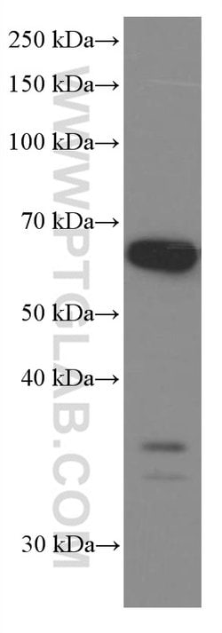 P4HA1 Mouse anti-Human, Mouse, Rat, Clone: 1H10A6, Proteintech 150 &mu;L;
