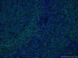 CD22 Mouse anti-Human, Clone: 7A2F1, Proteintech:Antibodies:Primary Antibodies