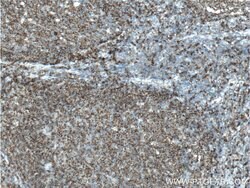 CD22 Mouse anti-Human, Clone: 7A2F1, Proteintech:Antibodies:Primary Antibodies